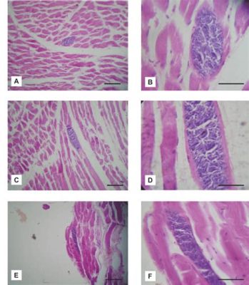  Sarcocystis! A Microscopic Wanderer With an Appetite for Mammalian Muscles